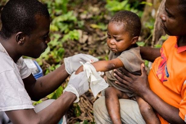 Surges in Monkey Pox in DR Congo  Forces Experts into a `Crisis Management` Meeting